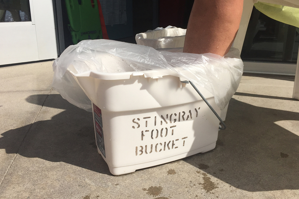Stingray Injury Treated with Foot in a Bucket of Hot Water