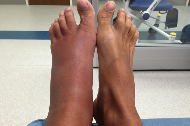 Stingrays: Shuffling your feet does NOT deter them. Here's what does.